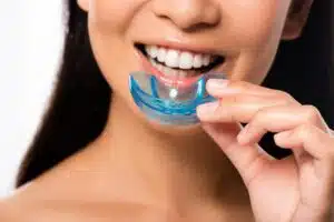 Orthodontic Treatment and Mouth Guards