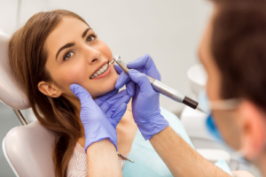 Cost of Braces for Adults in Gallup