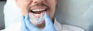 Protecting Your Smile: Best Mouth Guards in Cortez for Sports Seas