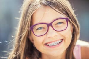 average time braces take