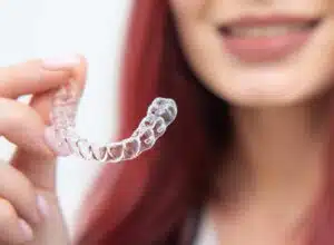 How Long to Straighten Teeth with Invisalign