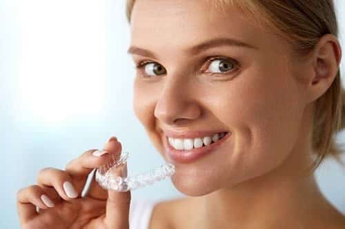 What do Invisalign aligners look like on a woman with Invisalign