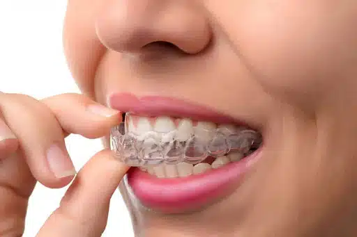 Patient holding clear aligners during orthodontic consultation