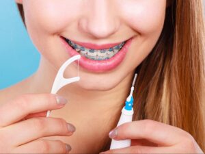 Brushing around braces to protect enamel from white spots